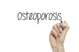 ask-dr-mike-osteoporosis-prevention-virus-help