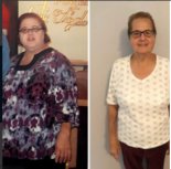 bariatric-surgery-a-patient-story-beverly