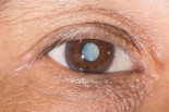 Cataracts: Symptoms &amp; Solutions