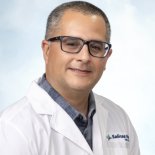 Terapia de Radiación con Radioembolización (Tratamiento con Y-90) para el Cáncer de Hígado