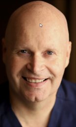 ep-1-254b-foot-conditions-including-bunions-plantar-fasciitis-everything-in-between