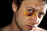 Severe Facial Lacerations &amp; Other Injuries