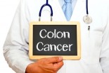 Ask Dr. Mike: Fighting Colon Cancer &amp; Reducing Tumor Burden