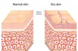 DIY Secrets to Combat Dry Winter Skin