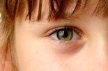 Eye Health: Your Child&#039;s Eyes Need Your Attention