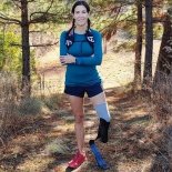 world-record-ultrarunner-and-amputee-how-i-beat-cancer