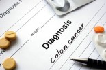colon-cancer-on-the-rise-in-young-adults